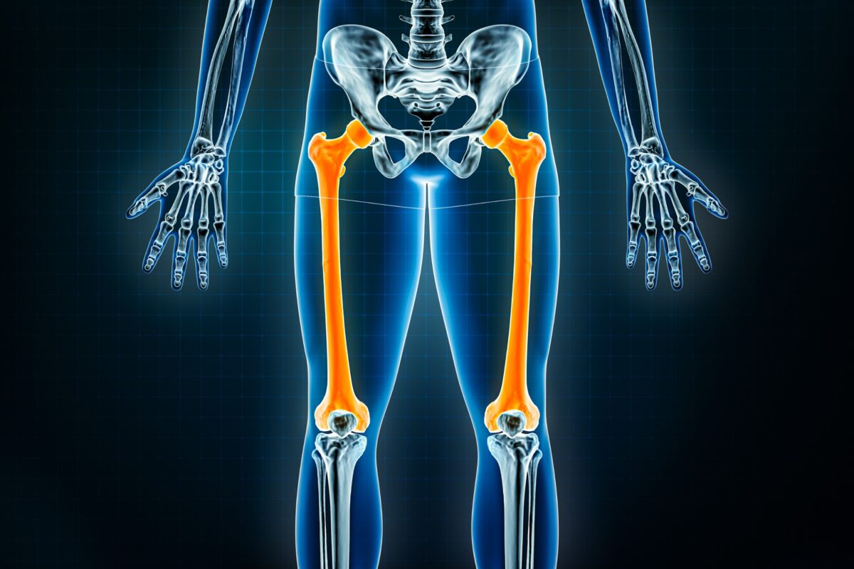 vitamins for bone health based on DNA