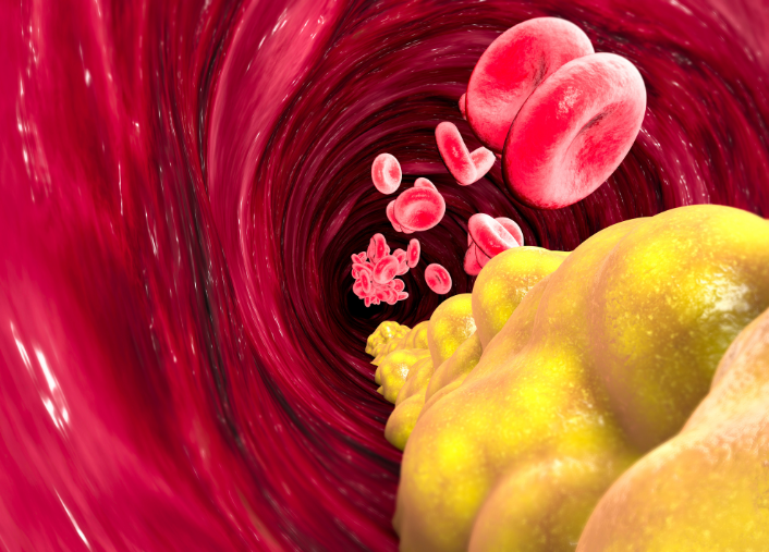 Cholesterol Levels