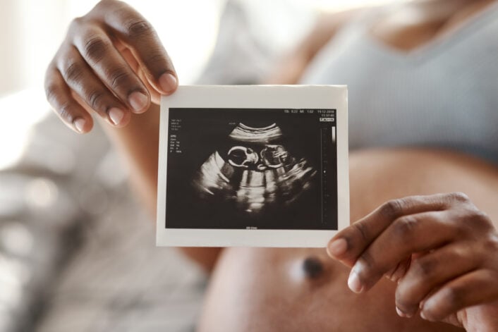 A woman holding a sonogram, symbolizing genetic inheritance and conditions like GRACILE Syndrome.