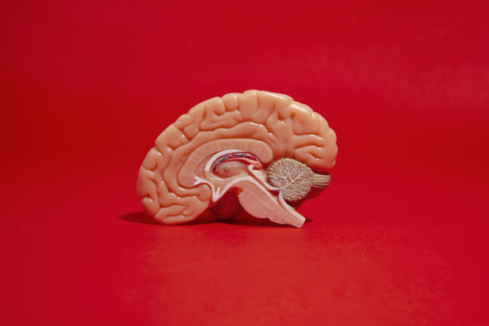 An actual human brain, representing the neurological effects of Leigh Syndrome.