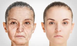 An image of the same woman at two different ages, representing the potential effects of mTOR and rapamycin on aging and longevity.