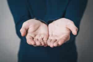 Open palm hands showing signs of Raynaud’s disease with pale or bluish fingers