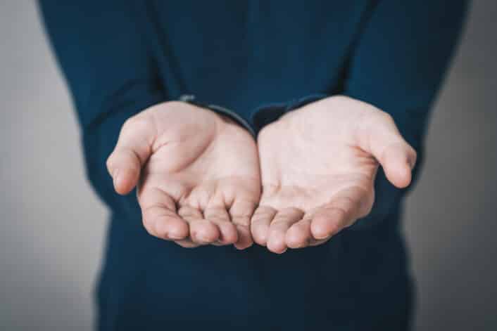 Open palm hands showing signs of Raynaud’s disease with pale or bluish fingers