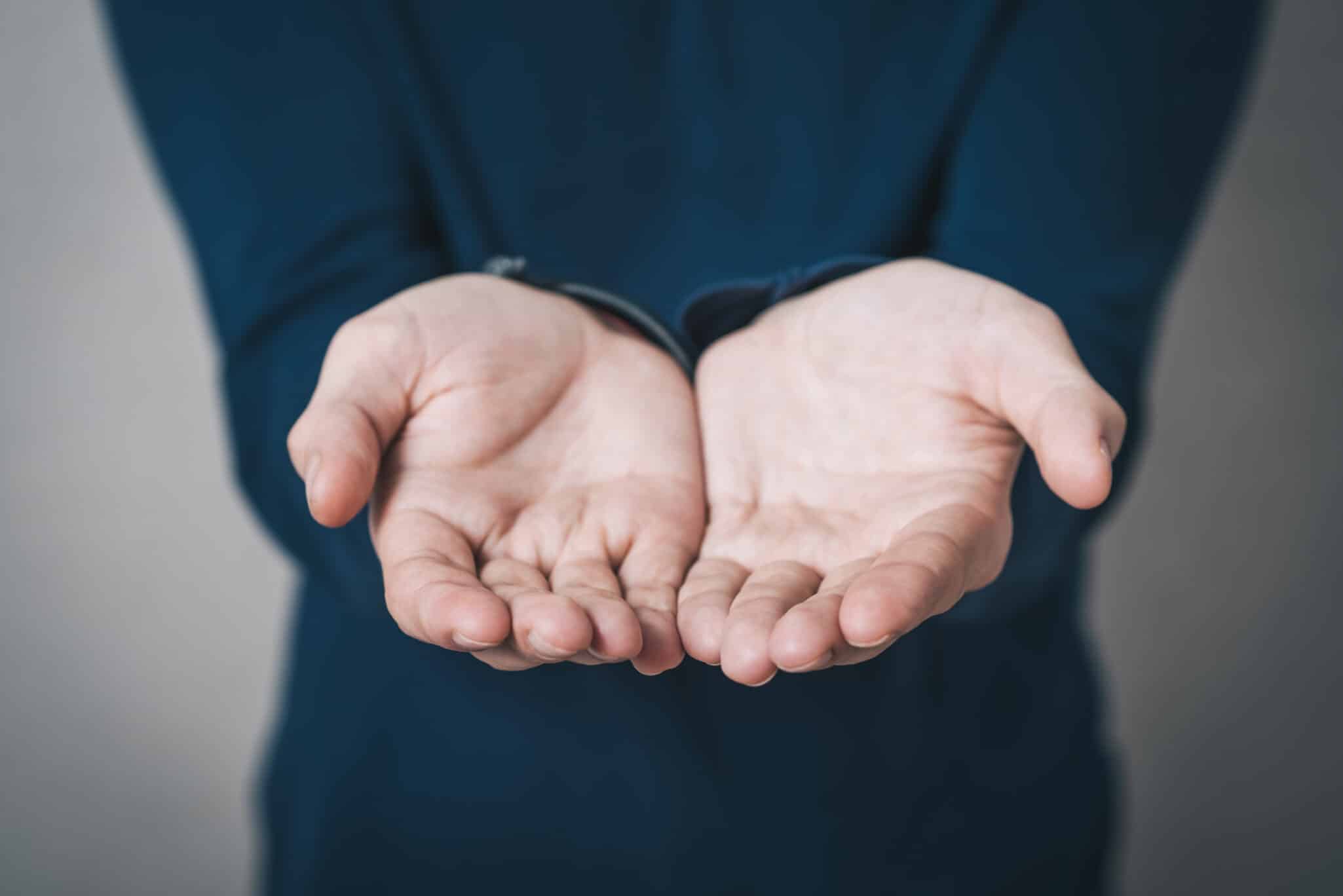 Open palm hands showing signs of Raynaud’s disease with pale or bluish fingers